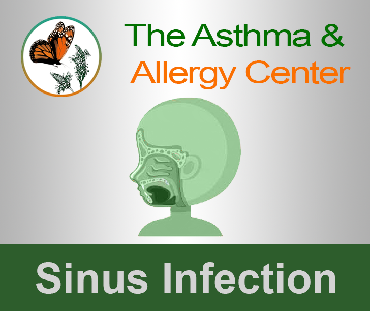 Sinus Infection (Chronic Rhinosinusitis)